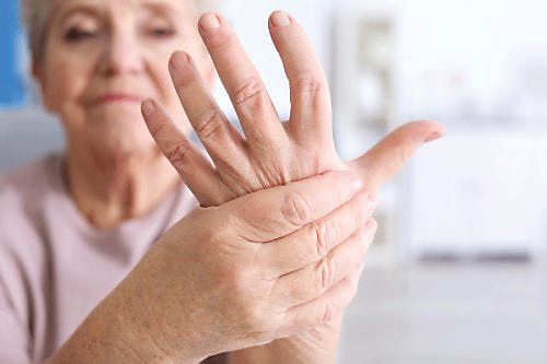 klinika za artritis i artrozu kako sol utječe na bolove u zglobovima